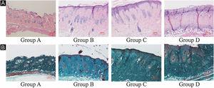 Histological changes of mouse back skin under different doses of UVB irradiation. See Figure A for HE is staining and Figure B for Masson staining. Radiation of Group A dose is 0 mJ/cm2; Radiation of Group B dose is 90 mJ/cm2; Radiation of Group C dose is 180 mJ/cm2; Radiation of Group D dose is 360 mJ/cm2. Scale bars are 100 µm.