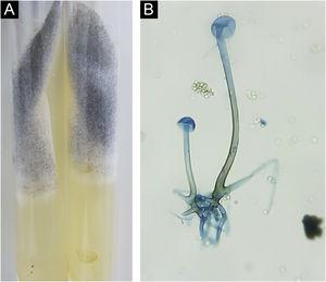 Rhizopus microsporus. (A), Colony consisting of whitish “cotton-wool” mycelium and blackish granular aerial mycelium. (B), Microculture showing coenocytic hypha with rhizoids, sporangiophore and empty sporangia. The presence of sporangiospores is observed around the structure (Cotton blue, ×400).