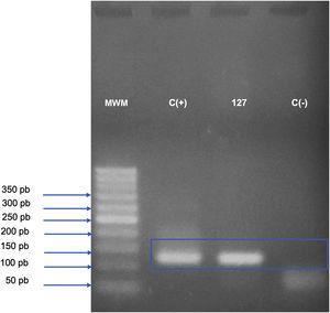 Analysis of the kinetoplast minicircle DNA fragment (mitochondrial DNA or kDNA) of Leishmania spp., amplified by conventional Polymerase Chain Reaction (PCR) and detected by electrophoresis in 2.5% agarose gel. The bands observed on the gel represent the PCR product (amplicon) of 116‒120 base pairs, generated from the amplification with kDNA-F and kDNA-R primers; the gel was stained with Safe Dye (Cellco Biotech do Brasil). MWM, 50 bp Molecular Weight Marker (Cellco Biotech do Brasil); C(+), Positive control (DNA extracted from culture ‒ Leishmania amazonensis – 40ng/L); 127, DNA extracted from a skin biopsy specimen from the right medial malleolus region, fixed in formalin and paraffin-embedded; C(-), Negative control (sterile water).