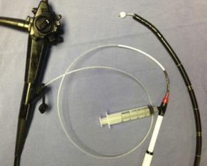 Endoscopio Pentax de 9mm con canal operatorio de 2.8mm, con canastilla de dormia que pasa a través del mismo y con algodón en la punta.