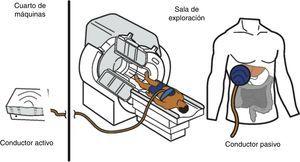Esquema de los componentes del equipo de elastografia por resonancia magnética. En el cuarto de máquinas se encuentra el equipo conductor activo que genera pulsaciones. Estas se transmiten en forma de ondas a través de un tubo de plástico que conecta dicha máquina con la paleta, que es un conductor pasivo de 10cm de diámetro que se coloca frente al hígado y las transmite al órgano. La paleta se fija al cuerpo con una banda elástica.