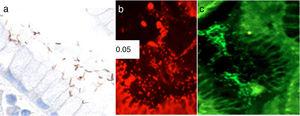 Fotomicrografías de mucosa gástrica. a) Identificación de H. pylori a través de immunohistoquímica. b) FISH positiva (cepa H. pylori resistente): presencia de resistencia a mutaciones de claritromicina (puntos rojos). c) FISH negativa (cepa H. pylori sensible): no resistencia a las mutaciones de claritromicina.