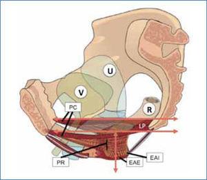 Relación de musculatura piso pélvico y órganos pélvicos Pelvis femenina. Disposición de las fibras del músculo elevador del ano, haz pubococcígeo (PC) y puborrectal (PR). Ubicación y relación con esfínter anal interno (EAI) y externo (EAE) y órganos pélvico de anterior a posterior: vejiga (V), útero (U) y recto (R). Modificado de Ref.2, Herschorn S. Female pelvic floor anatomy: the pelvic floor, supporting structures, and pelvic organs. Rev Urol. 2004;6 Suppl 5:S2-S10.