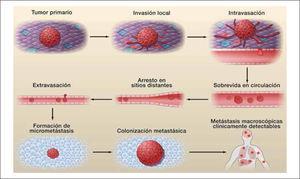 Cascada invasión -metastasis