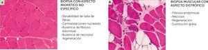 Biopsia muscular, estudio de microscopio óptico con tinción Hematoxilina-Eosina (A) Aspecto de una miopatía no distrófica, que puede mostrar muestra alteraciones (variabilidad de talla de fibras, centralizaciones nucleares) pero no contiene anomalías distróficas (fibrosis endomisial, fibras en necrosis o regeneración, sustitución de músculo por adipocitos (B). En realidad, las dos imágenes corresponden a dos biopsias musculares de una paciente de 14 años con mutaciones en el gen SEPN1. Las dos biopsias fueron realizadas con 3 meses de diferencia, una a nivel del músculo deltoides (A) y el otra en un músculo abdominal, en el curso de una cirugía de columna (B). La biopsia del músculo deltoides muestra anomalías no específicas de una miopatía congénita (A), mientras que la biopsia de músculo axial es muy distrofia (B) (Cortesía de A. Ferreiro).