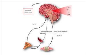Un estresor crónico activará el HHA y aumenta la liberación de cortisol. La persistencia del estímulo provoca la pérdida de la retroalimentación negativa. La liberación permanente de cortisol da paso a cambios desadaptativos que desregulan los factores inflamatorios. La elevación de citoquinas disminuye el Factor Neutrófico Derivado del Cerebro (BDNF) y la neurogénesis impactando negativamente en la transmisión monoaminérgica. La vía descendente del dolor, dependiente de monoaminas, pierde su capacidad de inducir analgesia [30,31].