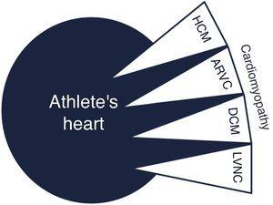 Overlap between cardiomyopathy and athlete's heart. ARVC: arrhythmogenic right ventricular cardiomyopathy; DCM: dilated cardiomyopathy; HCM: hypertrophic cardiomyopathy; LVNC: left ventricular noncompaction.
