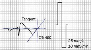 Electrocardiogram with coved pattern showing QT interval calculated by the tangent method.
