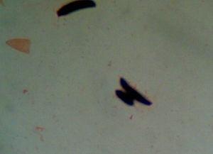 Direct microscopic observation of the right foot sample. Gram stain (1000×).