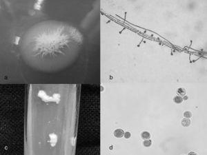 (a) Blastomyces dermatitidis, cultură filamentoasă în agar Sabouraud dextroză 28°C, 25 de zile; (b) Microconidii sesile și microconidii care ies din conidiofori scurți (