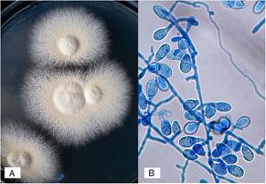 (A) Macromorphology of the N. nana colony (Sabouraud medium); (B) macroaleurioconidia characteristic of N. nana.