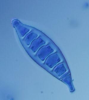 Macroconidium of Microsporum canis. This species is the main causal agent of ringworm in cats and dogs.