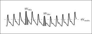 Variación de la onda de pulso. Imagen reproducida con el permiso de Pulsion Medical Systems. VS: volumen sistólico. Máx: máximo; Mín: mínimo.