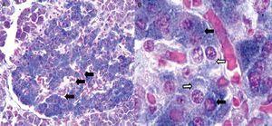 Imágenes tomadas con microscopio óptico de un corte de páncreas humano. 2A: vista con objetivo de bajo aumento (20X) donde se muestra uno de los islotes de Langerhans (en el centro). Las flechas señalan capilares distribuidos en toda la estructura del islote. 2B: en esta imagen del islote con objetivo de 100X se observan capilares rodeados por células que con la técnica de Gomori se distinguen como beta (azul intenso) y no beta (citoplasma rojo o pálido de aspecto granular). Las flechas negras señalan células beta, mientras que las flechas blancas señalan típicas células no beta.
