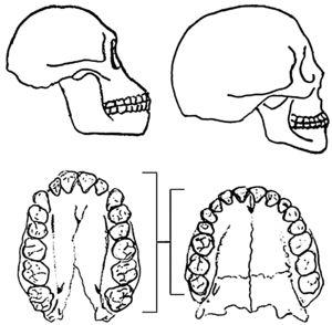 Evolución del aparato masticatorio. Representación esquemática de un cráneo de Australopithecus (izquierda) y de Homo sapiens (derecha). Perder desarrollo posteroanterior ha hecho que la arcada dental del Homo sapiens se haya tenido que ensanchar para que quepan el mismo número de dientes.