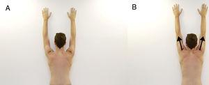Overhead shrug. Exercise starts with the individual standing, placing the arms in overhead position against the wall (A) and performing a shrug movement (B) and returning to the starting position.