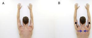 Retraction overhead. Exercise starts with the individual standing, placing the arms in overhead position against the wall (A) and lifting both arms (black arrows) while performing retraction (blue arrows) of the shoulders (B), then return to the starting position.