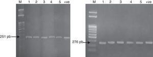 QRDR amplification of gyrA (251bp) and parC (276bp) from DNA of five Salmonella isolates.