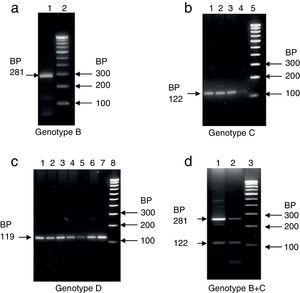 Agarose gel profiles of HBV genotypes. (A) Genotype B: lane 1 (46) (sample ID); lane 2 – 100bp DNA ladder; (B) genotype C: lanes 1–4 (165, 80, 66, 24) (sample ID); lane 5 – 100bp DNA ladder; (C) genotype D: lane 1–7 (7, 22, 61, 86, 99, 125, 153) (sample ID); lane 8 –100bp DNA ladder; and (D) genotype B+C: lanes 1 and 2 (132, 173) (sample ID); lane 3 – 100bp DNA ladder.