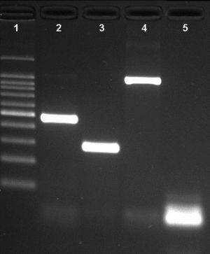 Agarose gel of a multiplex PCR showing the detection of the three pathogens from three different samples. Lane 1: 100bp DNA ladder; lane 2: Neisseria meningitidis (nspA gene with 481bp); lane 3: Haemophilus influenzae (P6 gene with 273bp); lane 4: Streptococcus pneumoniae (ply gene with 1000bp); lane 5: negative control.