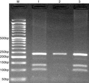 Electrophoresis pattern of the PCR-RFLP method for detection of CISH rs6768300 C>G polymorphism. The G allele undigested (234-bp), while C allele digested by HhaI restriction enzyme and produces 101-bp and 133-bp. M, DNA marker; Lanes 1 and 3, CG; Lane 2, GG.