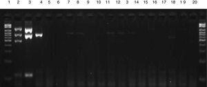 Electrophoresis gel illustrating the specificity of multiplex PCR. Lane 1: 100–2000bp Ladder; 2: mecA-positive S. aureus ATCC; 3: mecA-negative S. aureus ATCC; 4: CoNS ATCC; 5: Salmonella spp.; 6: Proteus mirabilis; 7: Morganella morganii; 8: Klebsiella pneumoniae; 9: Pseudomonas aeruginosa; 10: Acinetobacter baumannii; 11: Enterobacter cloacae; 12: Enterobacter aerogenes; 13: E. coli; 14: E. faecalis; 15: E. faecium; 16: Streptococcus viridans; 17: Streptococcus pneumoniae; 18: Candida spp.; 19: Gram-positive bacilli.