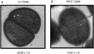 Transmission Electronic Microscopy images of CoNS under division, for observation of cell wall thickness (in nanometers). a) S. hominis b) S. epidermidis ATCC 12228.