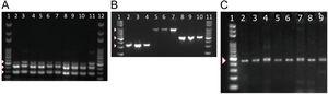 PCR amplification of MexAB-OprM system, pyoverdine receptors genes, and the β-lactamase gene blaTEM. Detection of mexA, mexB and mexR genes of P. aeruginosa isolates by PCR (A). Lane 1 and 12 corresponds to the molecular weight marker (100 bp DNA ladder). Amplicon sizes: mexA (503 bp), mexB (280 bp) and MexR (411 bp). Positive bands are indicated by white arrowheads. Molecular detection of pyoverdine receptor genes fpvAI, fpvAII and fpvAIII genes from P. aeruginosa isolates by PCR (B). Lane 1 and 11 corresponds to the 100 bp DNA Ladder. Lanes 2-4: fpvA type I (326 bp); Lanes 5-7: fpvA type II (897 bp) and 8-10: fpvA type III amplicons (506 bp). Positive bands are indicated by white arrowheads. PCR Amplification and sequencing of blaTEM-like β-lactamase genes in eight positive isolates of P. aeruginosa (C). PCR detection of the β-lactamase gene blaTEM (425 bp). Lane 1 on panel A corresponds to the 100 bp molecular weight DNA ladder. Positive bands are indicated by a white arrowhead. Multiple sequence alignments showing homology to blaTEM-like genes from E. coli and P. aeruginosa are shown in Supplementary Fig. 2.