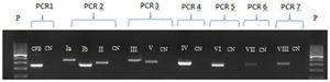 Electrophoresis gel for the seven PCRs for serotyping. P: molecular weight of 100 base pairs; CN: negative control; PCR 1: cfb extraction control; PCR 2: Capsular genotype Ia, Ib and II; PCR 3: Capsular genotype III and V; PCR 4: Capsular genotype IV; PCR 5: Capsular genotype VI; PCR 6: Capsular genotype VII and PCR 7: Capsular genotype VIII.