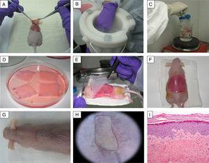 Generation of a skin-humanized mouse model. (A–C) The skin obtained from the wound made on the back of the anesthetized animal is devitalized by cycles of freezing in liquid nitrogen and thawing by immersion in boiling water. This devitalized skin is later fixed in place over the dermoepidermal equivalent to serve as a biological dressing that will protect the skin equivalent during the grafting process and will slough off naturally in approximately 2–3 weeks. (D–H) The dermoepidermal equivalent is orthotopically transplanted onto the wound created. (G–I) After 14 weeks, the images show the appearance of mice bearing regenerated human skin (delimited by dots), which is clinically and histologically distinct from murine skin (hematoxylin–eosin, ×10).