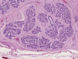 Mikroskooppinen kuva, yksityiskohta rintarauhaskudoksen acinoista ja kanavista (hematoksyliini-eosiini, alkuperäinen suurennos ×10).