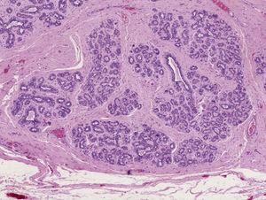 Mikroskopisk billede, detalje af brystvævets acini og kanaler (hematoxylin-eosin, original forstørrelse ×10).