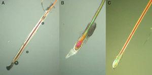 Proximal end of the hair shaft. A, Anagen hair. B, Catagen hair. C, Telogen hair. See Table 2 for characteristics. Polarized light microscope (original magnification ×40).