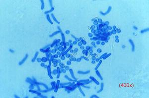 Sample Taking and Direct Examination in Dermatomycoses | Actas Dermo ...