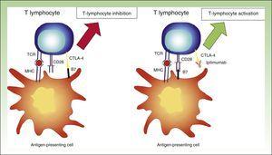 Diagram showing activity of ipilimumab. T-lymphocyte inhibition through binding between CTLA-4 and B7 (left). Activation of T lymphocyte through CTLA-4 blockade following binding between CTLA-4 and the monoclonal antibody ipilimumab. TCR indicates T-cell receptor; CD28, cluster of differentiation 28; MHC, major histocompatibility complex; CTLA-4, cytoxic T-lymphocyte associated protein 4.