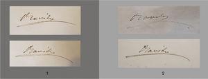 The signatures of the author on the illustrations of disseminated canities in the copies of the Atlas belonging to the Royal National Academy of Medicine (A) and the Olavide Museum (B).