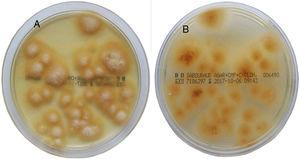Scale culture on Sabouraud chloramphenicol actidione agar plates for 15 days (28 °C). Flat colonies with starburst-like pattern at the edge can be observed, with a bright yellow color on the front (A) and reverse (B) side of the colony. In the middle of the colonies, a powdery white superficial mycelium developed with light radial folds.