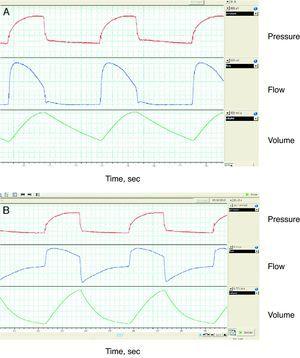 Monitoring of the flow–time wave with external pneumotachograph. In (A), the pneumotachograph is placed between the ventilator and the expiratory valve, which is pneumatic; therefore, the information from the expiratory phase is inexistent. In (B), the pneumotachograph is placed between the valve and the patient, therefore the information from the expiratory phase is complete. The register shows a tracing with support pressure, although the pressure wave is slightly distorted because a prolonged pressurization time (300ms) was used and the monitoring was done at the end of a standard 2m tube.