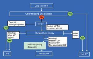 Guidelines For The Diagnosis And Treatment Of Idiopathic Pulmonary Fibrosis Archivos De Bronconeumologia