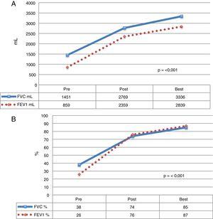 Functional parameters of CF patients who received LT. The mean of each value before LT, during the postoperative period, and the best mean values achieved during follow-up. (A) Values expressed as milliliters (ml). (B) Values expressed as percentage according to weight and height of each patient. FEV1: forced expiratory volume in 1 second; FVC: forced vital capacity.