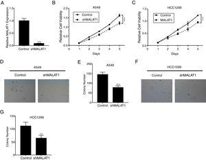 LncRNA MALAT1 promotes lung cancer cells proliferation. (A) The mRNA levels of LncRNA MALAT1 in A549 cells transfected with MALAT1 shRNA or control vector were determined by qPCR. (B) The proliferation of A549 cells transfected with MALAT1 shRNA was determined by MTT assay. (C) The proliferation of HCC1299 cells transfected with MALAT1 shRNA was determined by MTT assay. (D) The proliferation of A549 cells transfected with MALAT1 shRNA was determined by soft agar colony formation assay. (E) The statistical results of soft agar colony formation assay. (F) The proliferation of HCC1299 cells transfected with MALAT1 shRNA was determined by soft agar colony formation assay. (G) The statistical results of soft agar colony formation assay. *** P < .001.