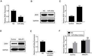 LncRNA MALAT1 promotes ZEB1 expression. (A) The expression of ZEB1 in A549 cells transfected with miR-200a was determined by qPCR. (B) The expression of ZEB1 in A549 cells transfected with miR-200a was determined by western blot. (C) The expression of ZEB1 in A549 cells transfected with MALAT1 expression plasmid was determined by qPCR. (D) The expression of ZEB1 in A549 cells transfected with MALAT1 expression plasmid was determined by western blot. (E) The expression of miR-200a in A549 cells transfected with miR-200a Inhibitor was determined by qPCR. (F) The expression of ZEB1 in A549 cells transfected with MALAT1 expression plasmid and/or miR-200a Inhibitor was determined by qPCR. ns, not significant. ** P < .01; *** P < .001.
