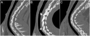 CT images, sagittal reconstructions. A) Control. B) D30 (undegraded stent). C) D90 (degraded stent).