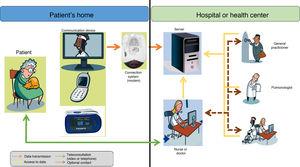 Architecture of home telemonitoring of patients from the hospital or health center.