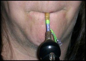 Bucal de um oboé (frente).