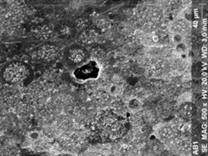 SEM micrograph of amalgam specimen exposed to 10% carbamide peroxide (500×).
