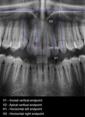 Point selection of the six teeth, on T-1 enhanced image.
