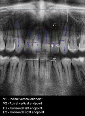 Point selection of the six teeth, on T-2 enhanced image.
