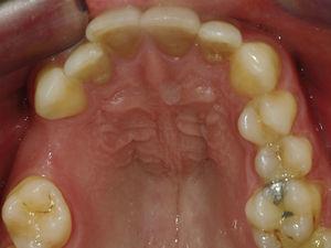 Preoperative intra-oral photography.