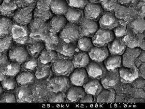 SEM photograph of a conditioned enamel surface with 37% phosphoric acid observed at ×1500.